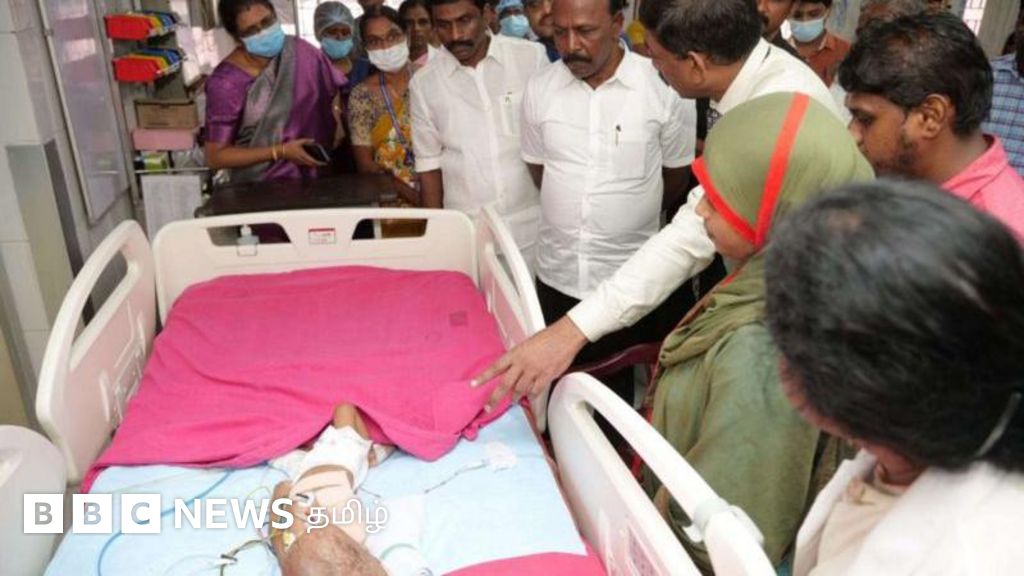 சென்னை அரசு மருத்துவமனையில் கை அகற்றப்பட்ட குழந்தை மரணம் - யார் தவறு?