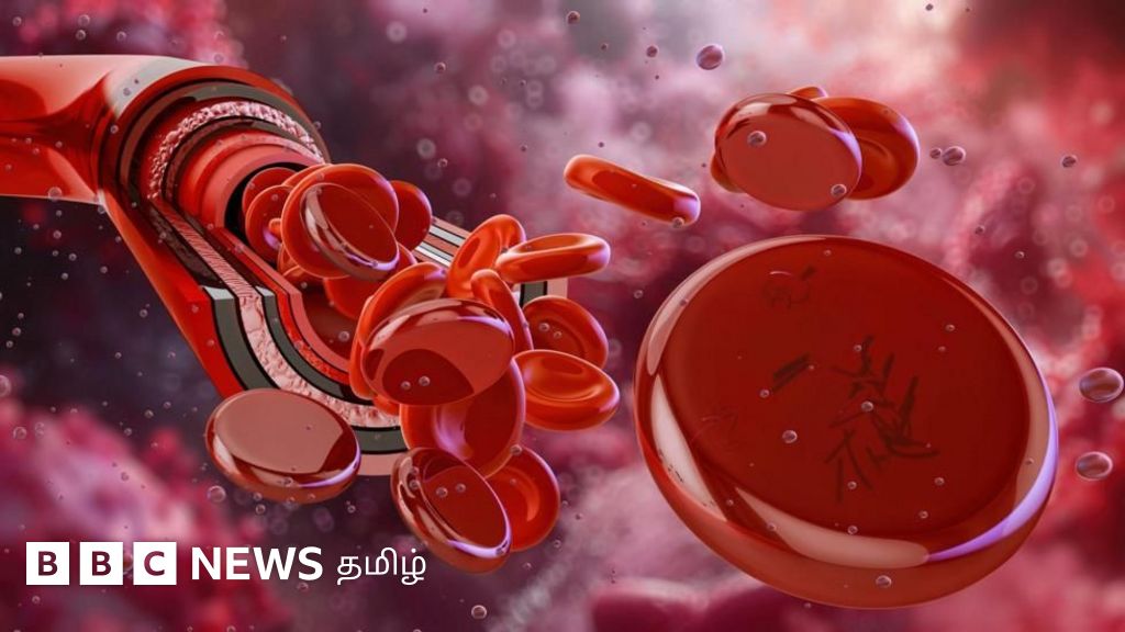 பெங்களுரு பெண்ணுக்கு உலகில் வேறு யாருக்கும் இல்லாத ரத்த வகை - இதய அறுவை சிகிச்சை எவ்வாறு நடந்தது?