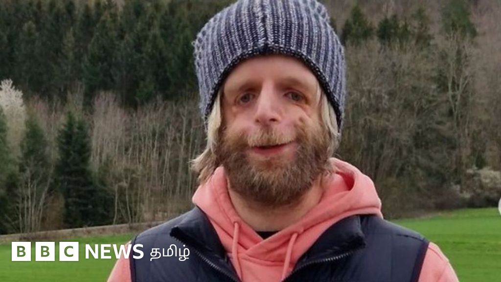 தன் முகத்தை தானே வெறுத்த இளைஞர் வாழ்வில் சாதித்த வெற்றிக் கதை