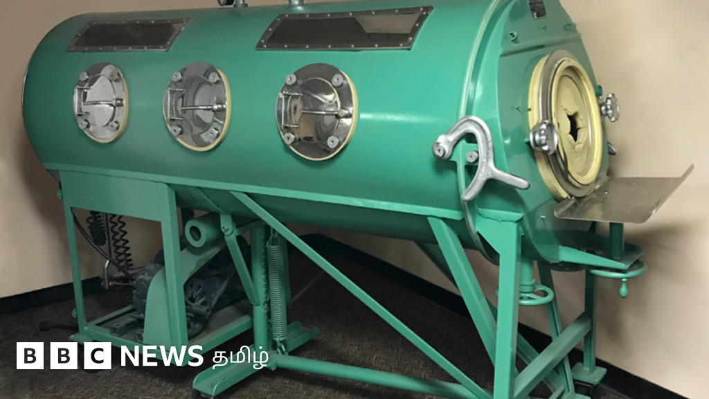 இரும்பு நுரையீரல்: கோடிக்கணக்கானோர் உயிரைக் காப்பாற்றிய ஒரு மகத்தான கண்டுபிடிப்பு