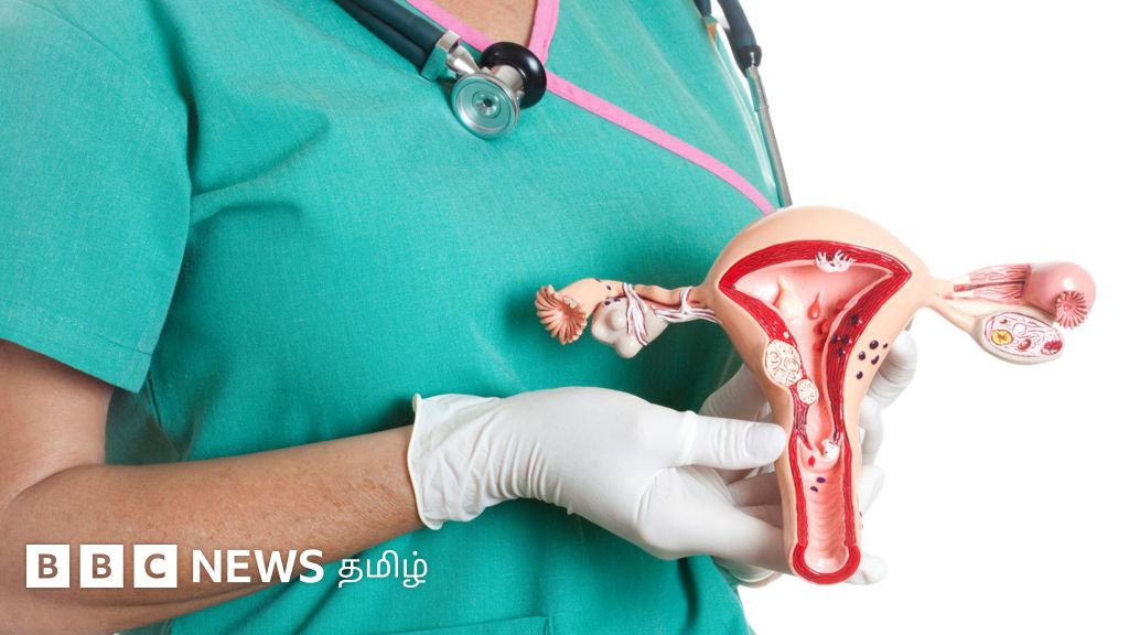 உலக சினைப்பை புற்றுநோய் தினம்: அறிகுறிகள், கண்டறியும் வழிகள் மற்றும் சிகிச்சைகள் - நிபுணர் விளக்கம்