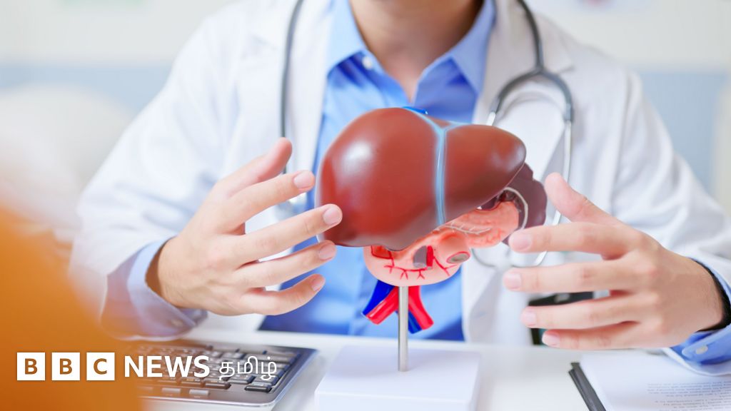 மது அருந்தாதவர்களையும் அறிகுறிகளே இல்லாமல் தாக்கும் 'கல்லீரல் நோய்'