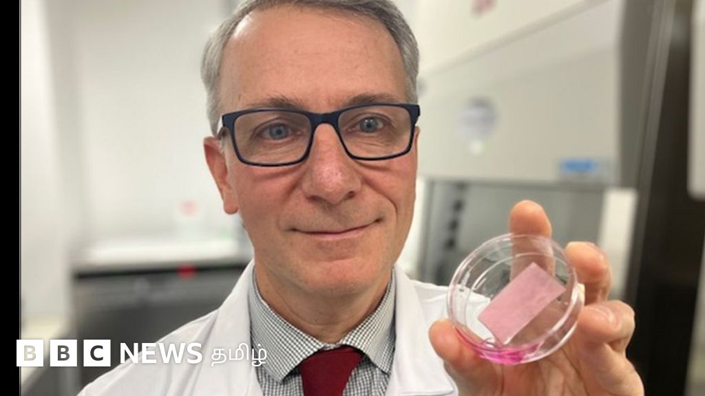 உலகில் முதன்முறையாக குழந்தையின் இதய செயலிழப்புக்கு ஸ்டெம் செல் மூலம் சிகிச்சை