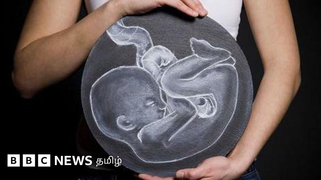 கருக்கலைப்பு செய்த போது உயிருடன் பிறந்த குழந்தை - எப்படி இருக்கிறது? யார் வளர்ப்பது?