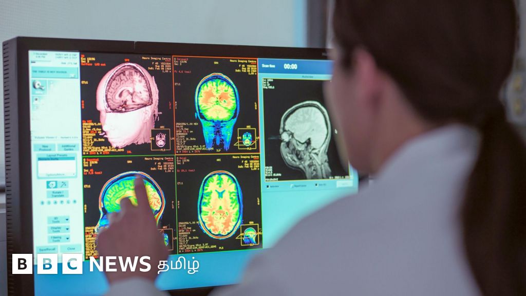 அதீத நினைவுத் திறன்; வரமா சாபமா? - உங்களுக்கு இந்த அறிகுறிகள் உள்ளதா?