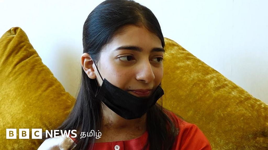 19 வயது பாகிஸ்தான் பெண்ணுக்கு 69 வயது டெல்லி நபரின் இதயம் பொருத்தம் - சென்னை மருத்துவர்கள் சாதனை