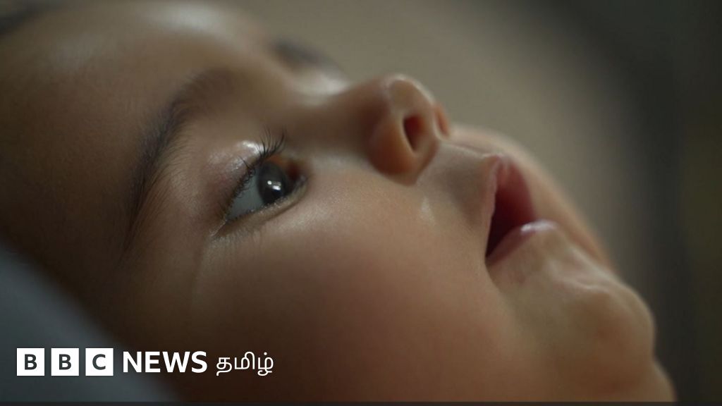 ஏழு மாதக் குழந்தை உயிருடன் இருக்க தேவைப்படும் ரூ.17 கோடி ரூபாய் மதிப்புள்ள ஊசி