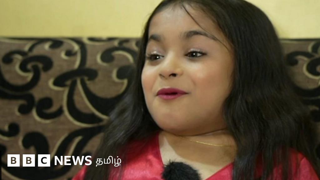 உயரம் குறைவு, சிறுநீர்ப்பை இல்லை: வாழ்க்கையின் யதார்த்தத்துடன் மாடலாக சாதிக்கும் மாற்றுத்திறனாளி பெண்