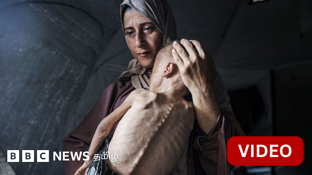 உலகின் மனசாட்சியை உலுக்கிய காஸா குழந்தையின் புகைப்படம்