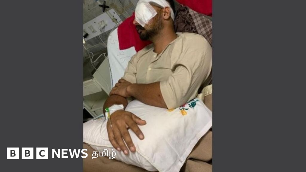 பிளாஸ்டிக் புல்லட் பட்டதில் கண் பார்வை இழந்த இளைஞர் - விவசாயிகள் போராட்டத்தில் என்ன நடக்கிறது? 