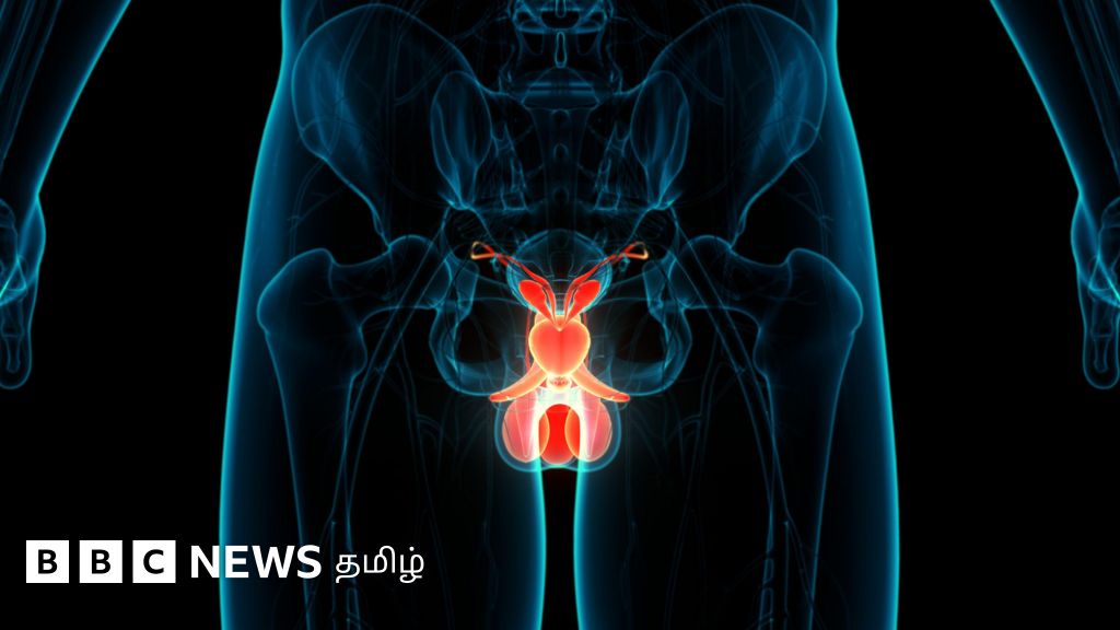 இந்திய ஆண்களுக்கு ப்ராஸ்டேட் புற்றுநோய் அதிகரிப்பது ஏன்? கண்டறிவது எப்படி?