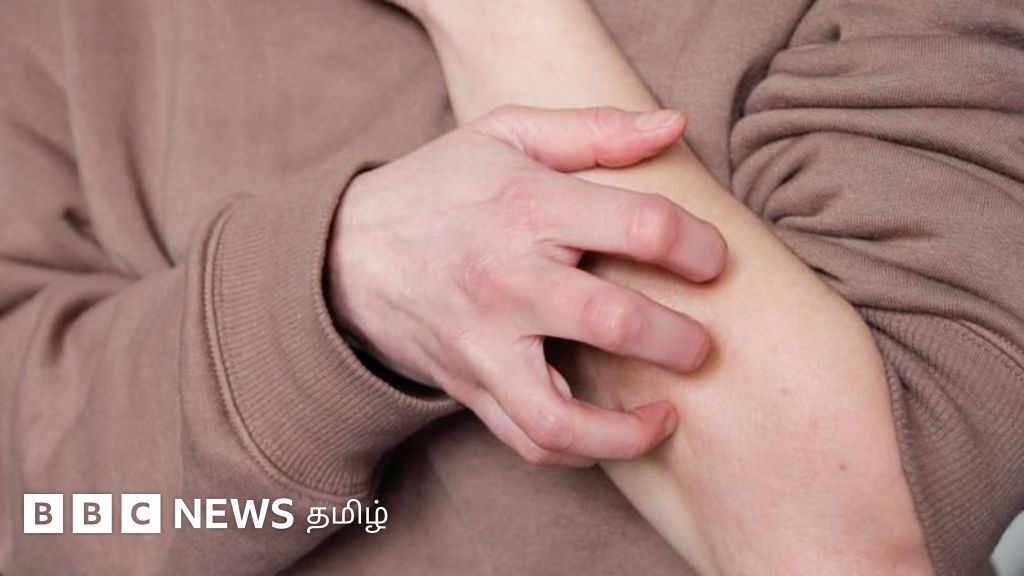 உடல் அரிப்பு: நாம் ஏன் சொறிந்து கொள்கிறோம்? கட்டுப்படுத்த முடியுமா?