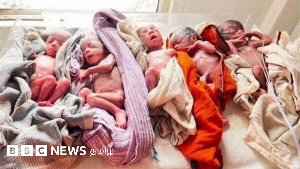 ராஞ்சியில் ஒரே பிரசவத்தில் 5 பெண் குழந்தைகள் - மகிழ்ச்சிக்கு பிறகு கவலையில் பெற்றோர்