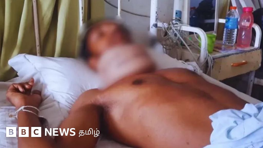 இலங்கையில் அந்தரங்க உறுப்பின் ஒரு விதையை இழந்த இளைஞர் - காவல்துறை தாக்குதல் காரணமா?