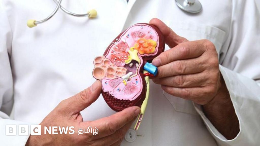 சிறுநீரகம் முதல் உமிழ்நீர் வரை உடலில் எங்கெல்லாம் கற்கள் உருவாகலாம்? அதனை தடுப்பது எப்படி?