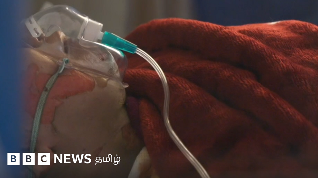 இராக் பெண்கள் தங்களைத் தாங்களே தீயில் எரித்துக் கொள்வது ஏன்?