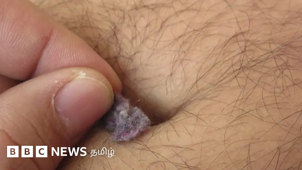 உங்கள் தொப்புளில் பருத்தி போன்று கழிவுகள் சேர்கிறதா? அதில் என்ன இருக்கிறது தெரியுமா?