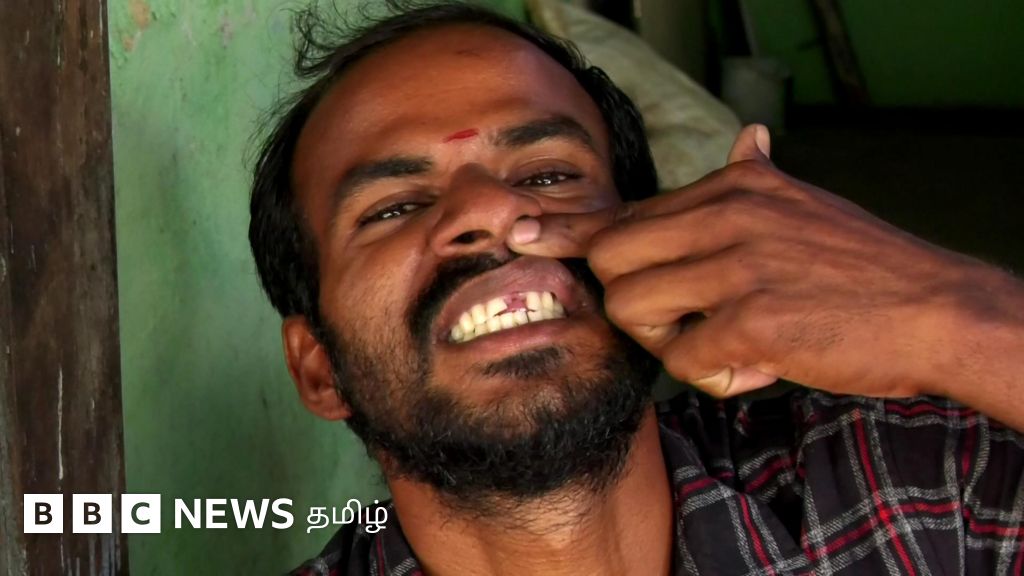 விசாரணைக் கைதிகளின் பல்லைப் பிடுங்கி போலீஸ் கொடுமை: 2 தனிப்பிரிவு காவலர்கள் இட மாற்றம்