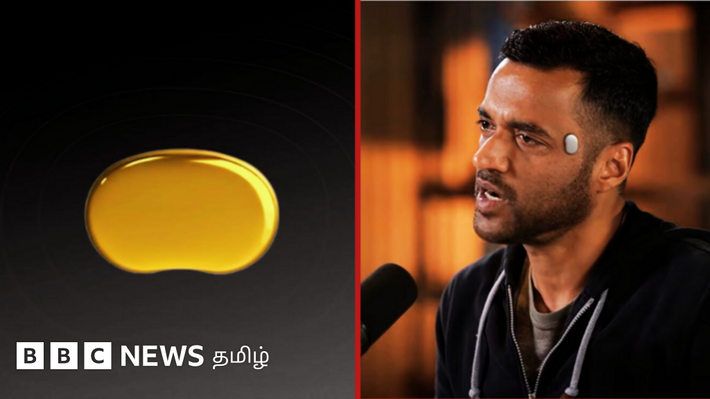 டெம்பிள்: ஸொமாட்டோ நிறுவனரின் நெற்றியில் இருக்கும் மின்னணு சாதனம் என்ன?