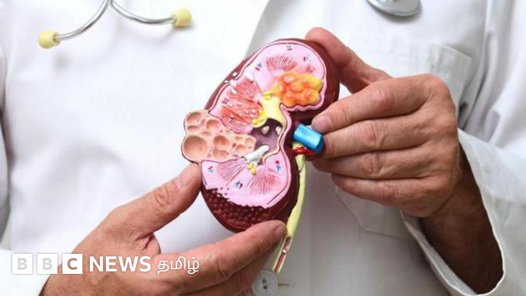 சிறுநீரக கல் முதல் உமிழ்நீர் கல் வரை எப்படி உருவாகிறது? வராமல் தடுப்பது எப்படி?