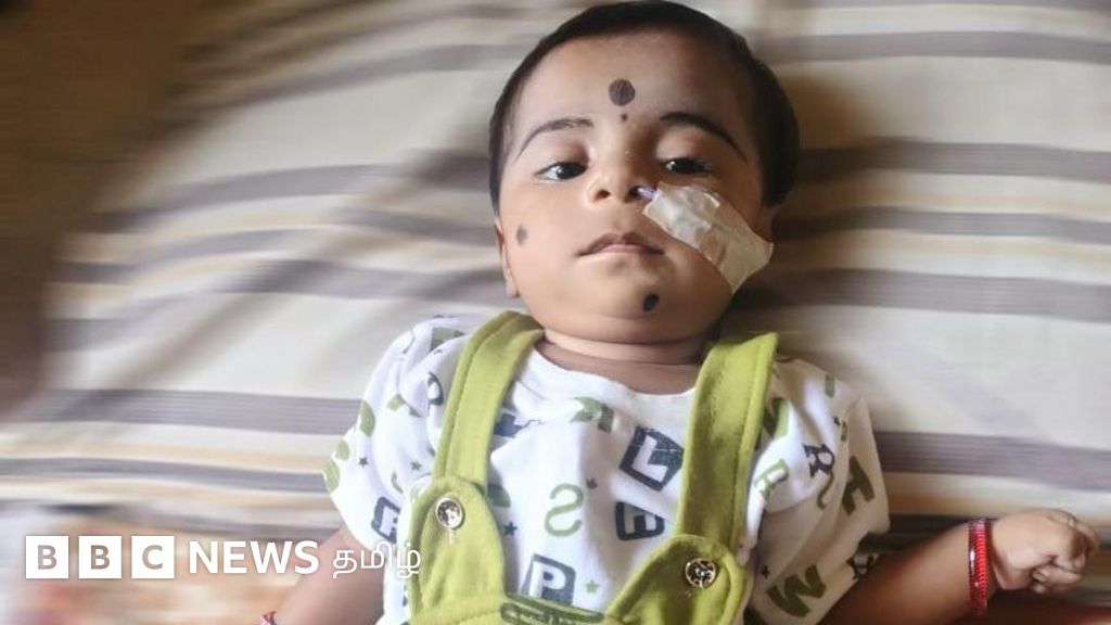 ஆறு மாத குழந்தையை பாதித்த அரிய வகை நோய்: அரசின் உதவி கிடைக்காமல் உயிரிழந்த சோகம்