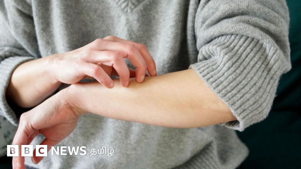 உடலில் நாள்பட்ட அரிப்பு ஏன் ஏற்படுகிறது? எப்படி குணப்படுத்துவது?