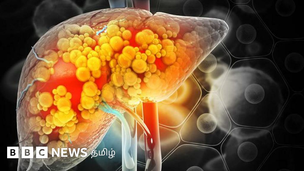 மது, சிகரெட் மட்டுமல்ல, இந்த பழக்கங்கள் இருந்தாலும் உங்கள் கல்லீரல் பாதிக்கப்படலாம் என்று தெரியுமா?