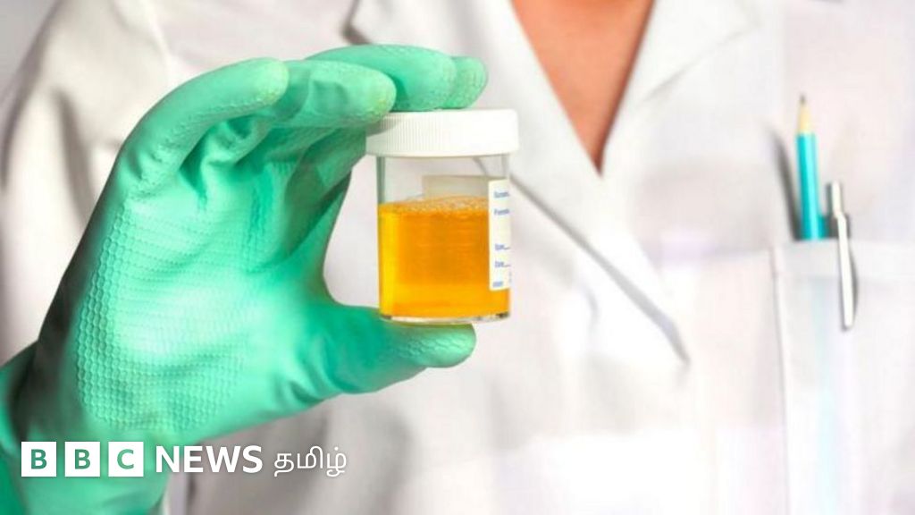 உங்களுக்கு சிறுநீர் நுரையுடன் வருகிறதா? இந்த நோய் ஏற்படலாம்