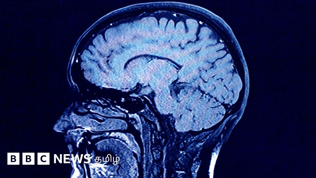 மனித மூளை முதிர்ச்சி அடைவதைத் தடுக்க வழி தேடும் விஞ்ஞானிகள் - என்ன கிடைத்தது?