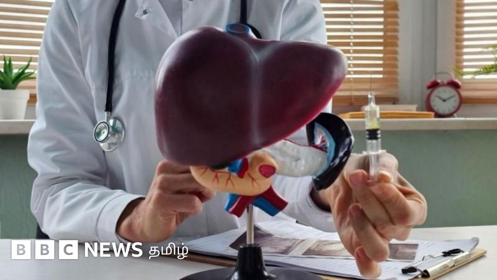 கல்லீரல் மாற்று அறுவை சிகிச்சை எப்போது, ஏன் தேவை? இயல்பு வாழ்க்கைக்கு திரும்ப எவ்வளவு நாளாகும்?