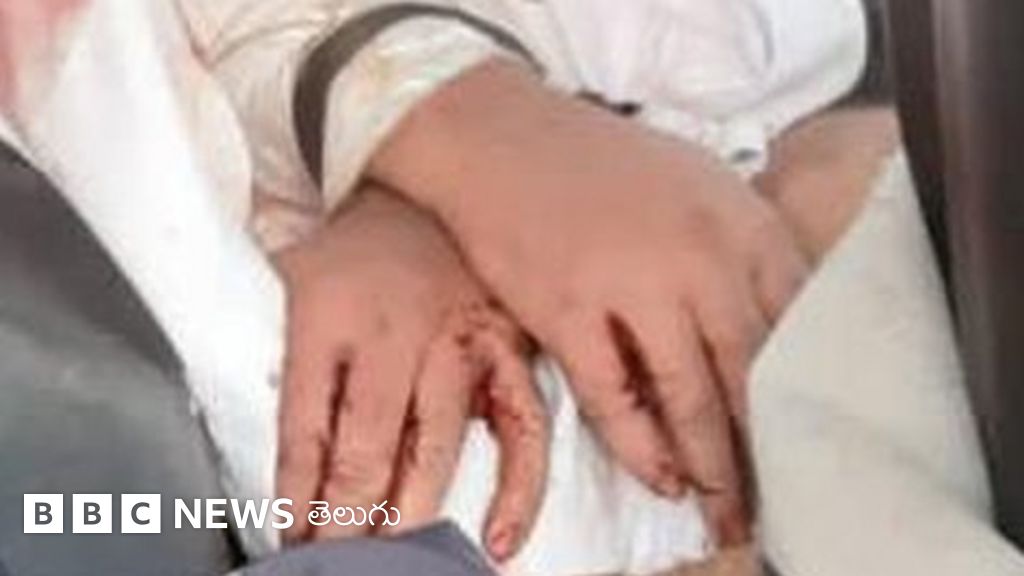 హైదరాబాద్‌లో డాక్టర్‌ కిడ్నాప్.. ఛేజ్ చేసి కాపాడిన ఏపీ పోలీసులు - Newsreel - BBC News తెలుగు