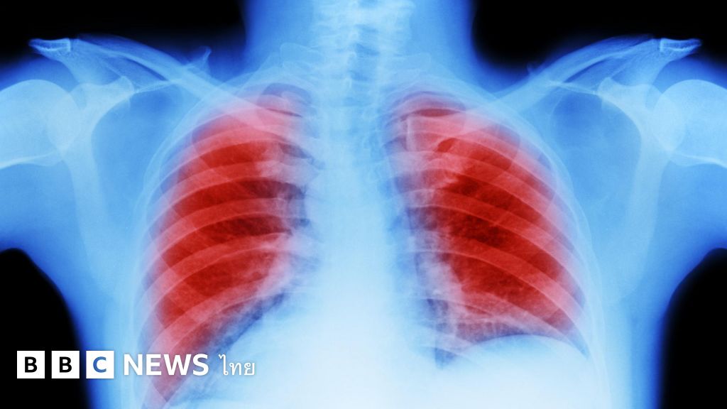 Lung cancer Scientists have discovered that How does air pollution lead to cancer? BBC News