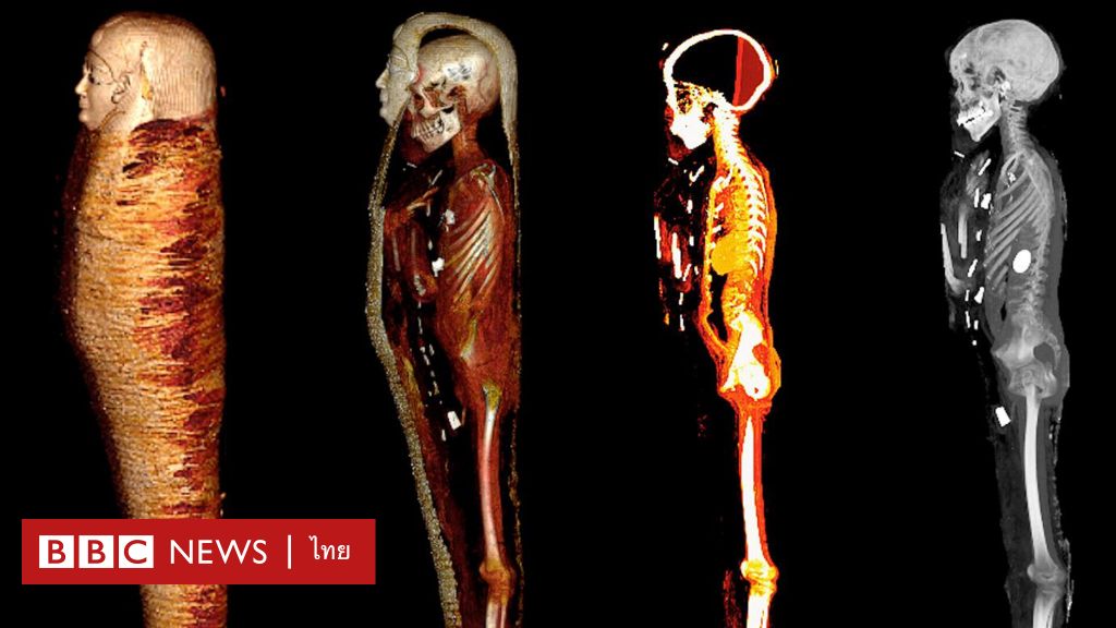 Scans reveal ‘Golden Boy’ mummy has 49 hidden amulets