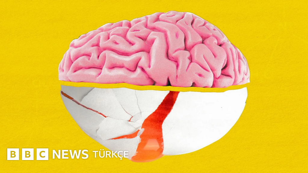 'Beyin besini' kolinin neden gözardı edildiği düşünülüyor?