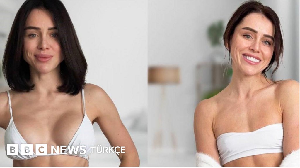 Kadınlar silikonlarını neden çıkarıyor?