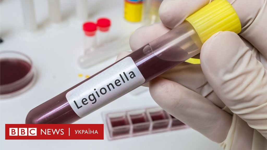 болезнь легионеров какой организм спровоцировал заболевание