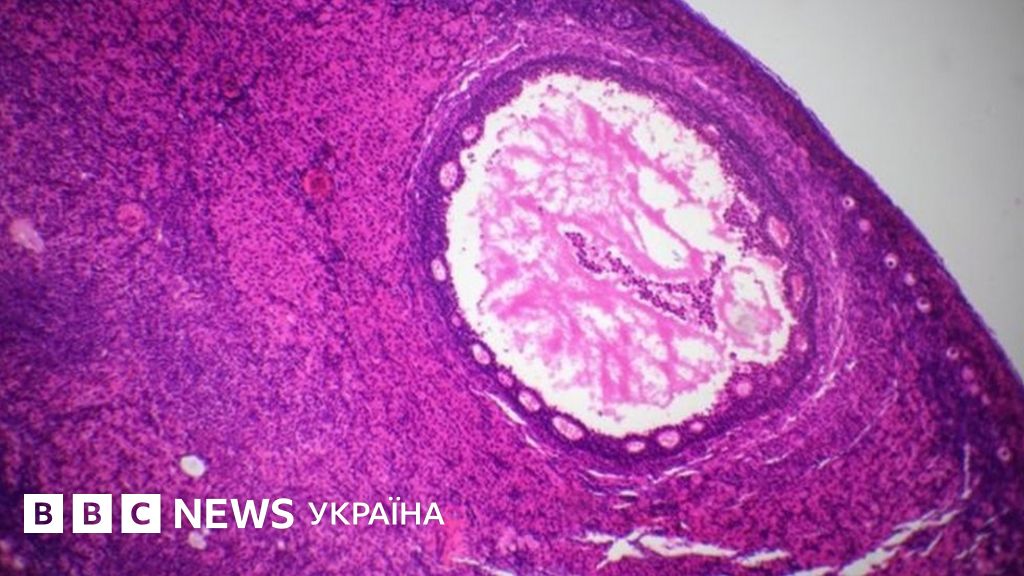 Вчені близькі до створення штучного яєчника - BBC News Україна