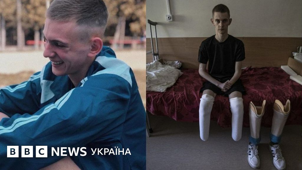 "Я сказав росіянам - ріжте дві". Історія Данила, який втратив на війні ...