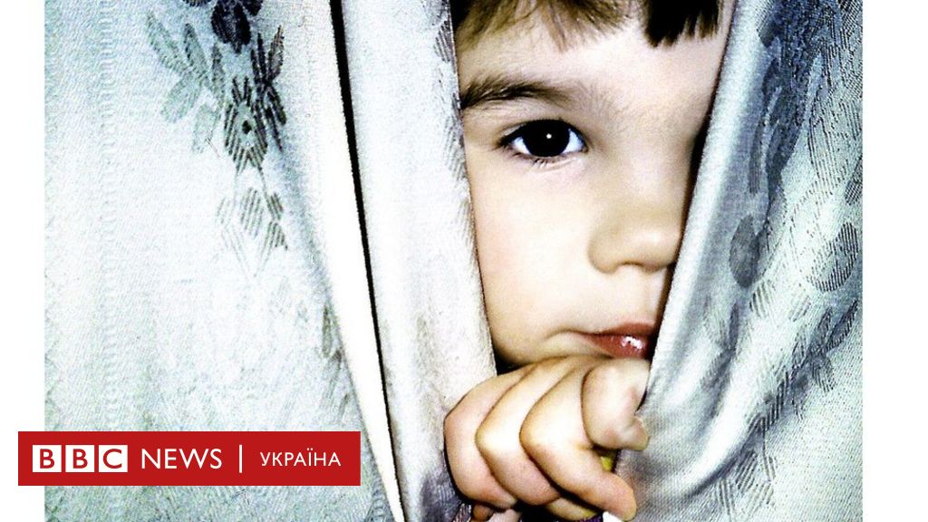 Как сделать синяк: не хитрые способы