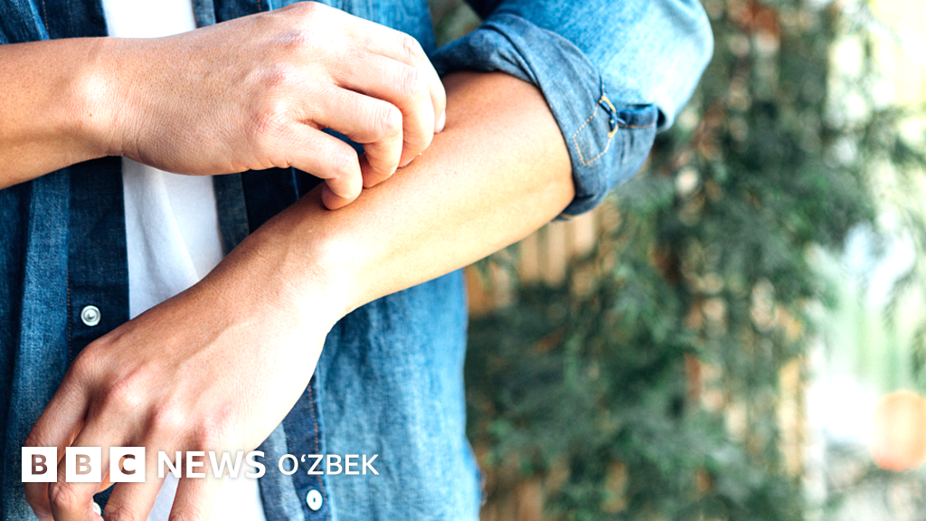 Nipellar yuqoriga orqadan tukli chanoq