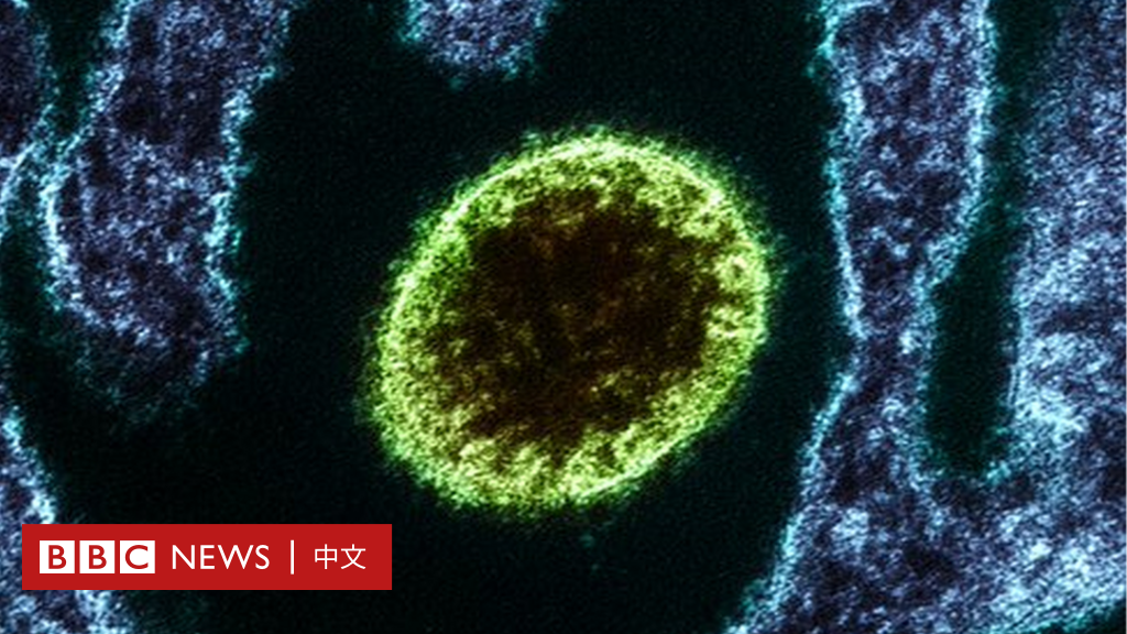 ‘Langya virus’: What is this virus recently discovered in China? – BBC News