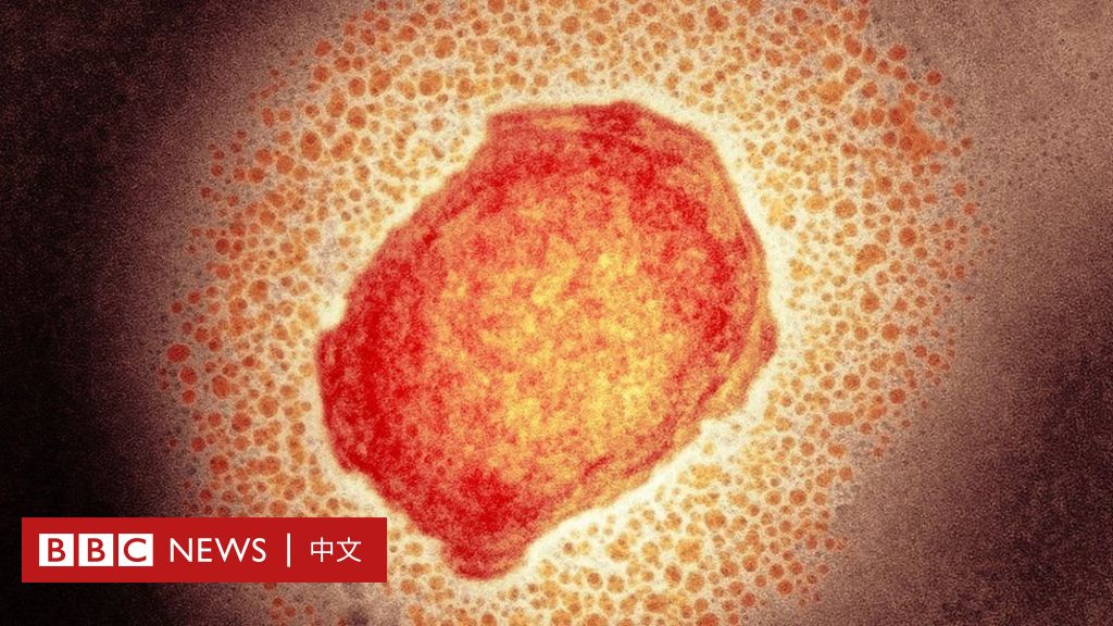 什么是猴痘：症状、传播、防疫等你可能想了解的问题