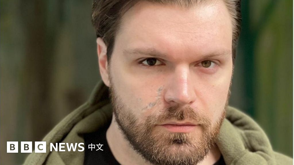 烏克蘭亞速鋼廠：獲釋亞速戰士講述被俄國關押的非人道待遇 BBC News 中文