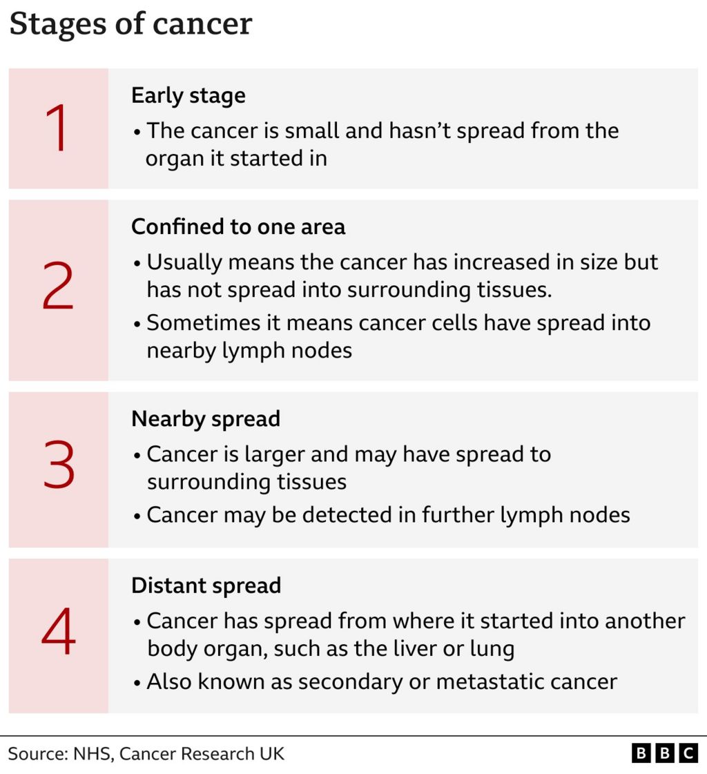 Graphic showing the stages of cancer
