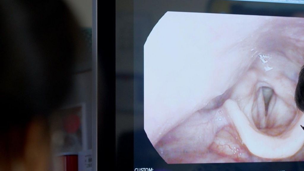 Screen image of David's vocal cords on a screen