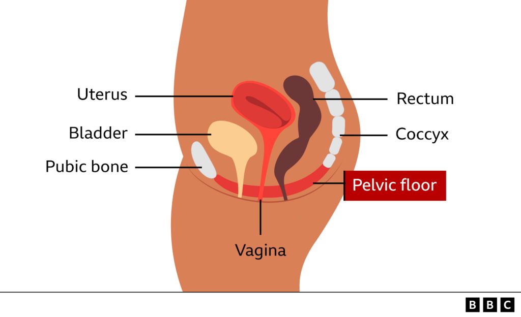 I noticed a bulging lump sensation in my vagina