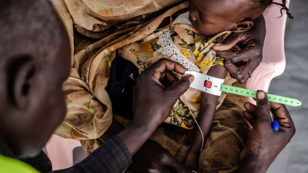 A health worker measures the circumference of a Sudanese child's arm at the clinic of a Transit Centre for refugees in Renk, South Sudan, in February.