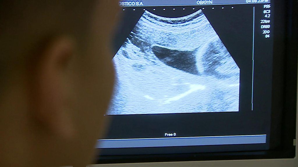 Colombia has highest number of Zika cases after Brazil BBC News