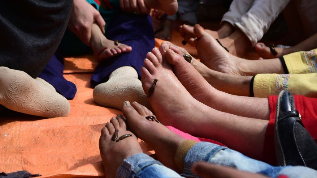 Kashmiri people take Leech treatment on the banks of Dal Lake Srinagar, Indian Administered Kashmir