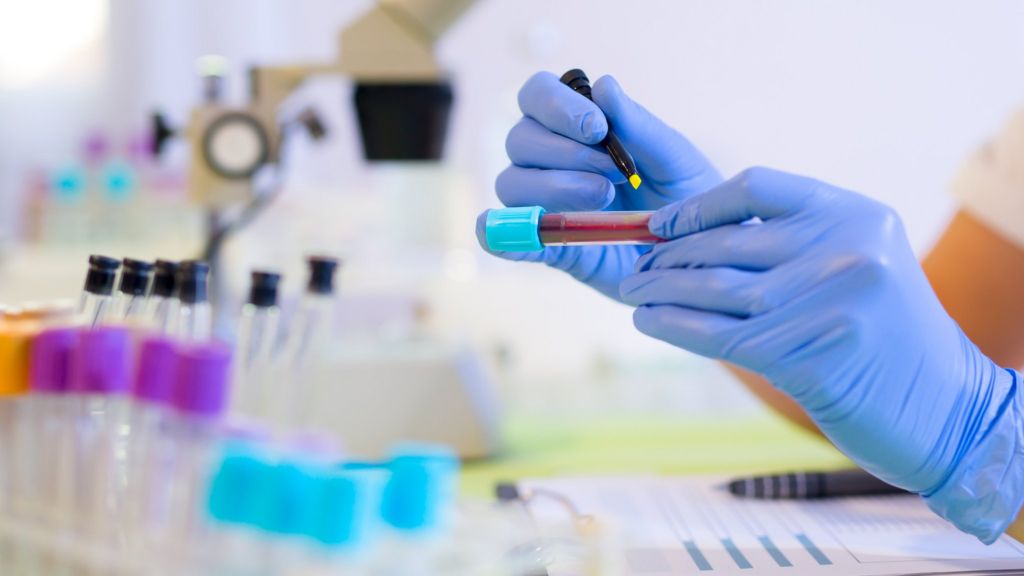 'Exciting' blood test spots cancer a year early